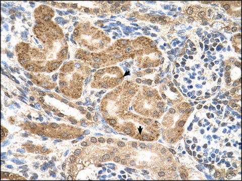 Anti-GMPPB antibody produced in rabbit IgG fraction of antiserum