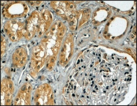 Anti-TRIM5 antibody produced in goat affinity isolated antibody, buffered aqueous solution