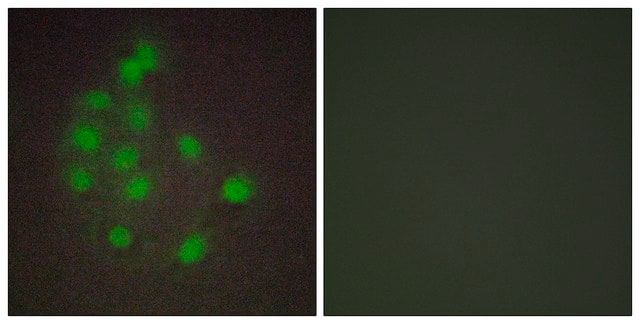 Anti-HAND1 antibody produced in rabbit affinity isolated antibody