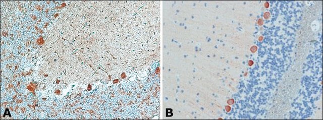 Anti-Myosin Va (LE-16) antibody produced in rabbit ~0.5&#160;mg/mL, affinity isolated antibody, buffered aqueous solution