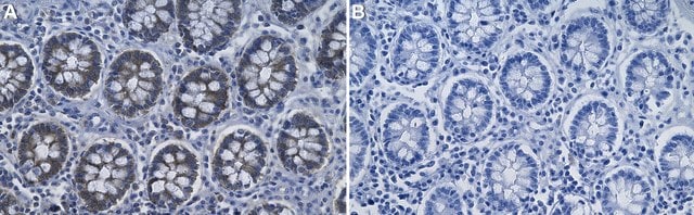 Anti-NMI Antibody, clone 1B2 ZooMAb&#174; Rabbit Monoclonal recombinant, expressed in HEK 293 cells