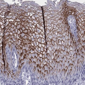 Anti-Dmkn Antibody Produced In Rabbit Prestige Antibodies&#174; Powered by Atlas Antibodies, affinity isolated antibody, buffered aqueous glycerol solution