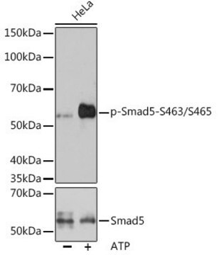 Anti-Phospho-Smad5-S463/S465 antibody produced in rabbit