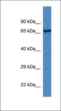 Anti-KLKB1 antibody produced in rabbit affinity isolated antibody