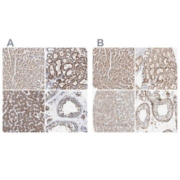 Anti-OXSM antibody produced in rabbit Prestige Antibodies&#174; Powered by Atlas Antibodies, affinity isolated antibody, buffered aqueous glycerol solution, Ab1