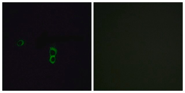 Anti-OR9Q1 antibody produced in rabbit affinity isolated antibody