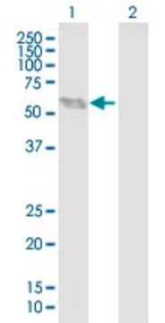 Anti-BCL6B antibody produced in mouse purified immunoglobulin, buffered aqueous solution