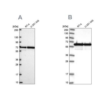 Anti-CCDC47 antibody produced in rabbit Prestige Antibodies&#174; Powered by Atlas Antibodies, affinity isolated antibody