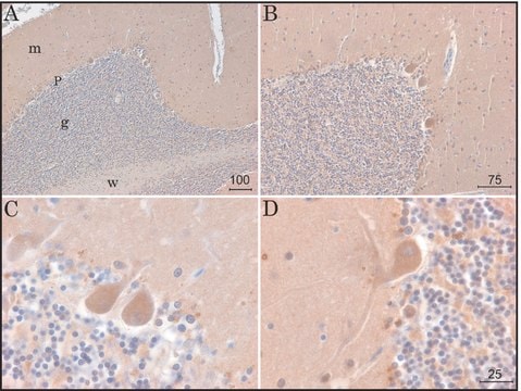 Anti-KCNK9 (TASK-3) antibody, Mouse monoclonal clone KCN-75, purified from hybridoma cell culture