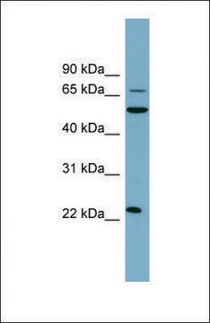 Anti-CLEC6A, (N-terminal) antibody produced in rabbit affinity isolated antibody