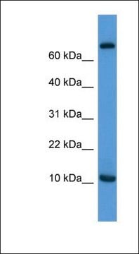 Anti-CCL20 antibody produced in rabbit affinity isolated antibody