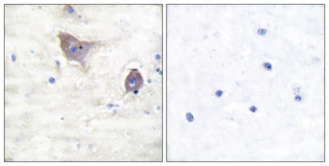 Anti-Synuclein &#946; antibody produced in rabbit affinity isolated antibody