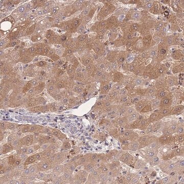 Anti-ZNF304 antibody produced in rabbit Prestige Antibodies&#174; Powered by Atlas Antibodies, affinity isolated antibody, buffered aqueous glycerol solution