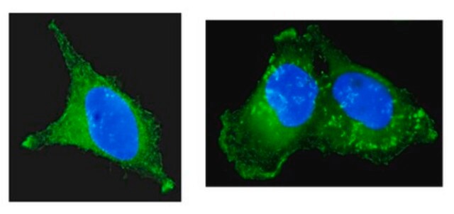 Anti-Cortactin (p80/85) Antibody, clone 4F11, Alexa Fluor&#8482; 488 clone 4F11, Upstate&#174;, from mouse