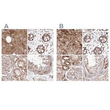 Anti-NUP43 antibody produced in rabbit Prestige Antibodies&#174; Powered by Atlas Antibodies, affinity isolated antibody, buffered aqueous glycerol solution, ab2