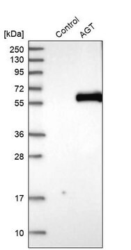 Anti-AGT antibody produced in rabbit Prestige Antibodies&#174; Powered by Atlas Antibodies, affinity isolated antibody, buffered aqueous glycerol solution