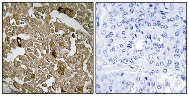 Anti-BTBD6 antibody produced in rabbit affinity isolated antibody