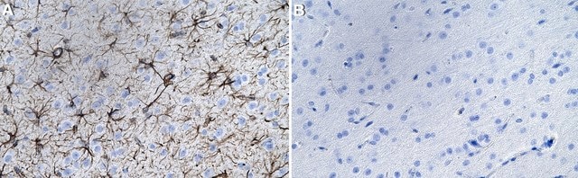 Anti-GFAP Antibody, clone GA5 ZooMAb&#174; Mouse Monoclonal recombinant, expressed in HEK 293 cells