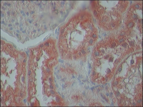 Anti-TDP-43 (N-terminal region) antibody produced in rabbit ~1.0&#160;mg/mL, affinity isolated antibody, buffered aqueous solution