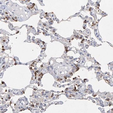 Anti-ZNF77 antibody produced in rabbit Prestige Antibodies&#174; Powered by Atlas Antibodies, affinity isolated antibody, buffered aqueous glycerol solution