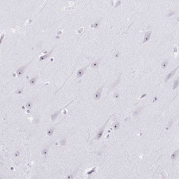 Anti-NOP10 antibody produced in rabbit Prestige Antibodies&#174; Powered by Atlas Antibodies, affinity isolated antibody, buffered aqueous glycerol solution