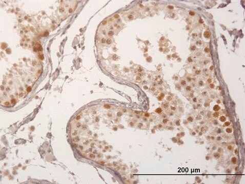 Anti-FBXO7 antibody produced in mouse purified immunoglobulin, buffered aqueous solution