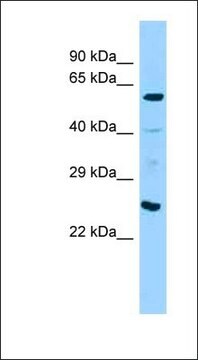 Anti-ANGPT1 antibody produced in rabbit affinity isolated antibody