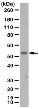 Anti-ZIP-8 Antibody from rabbit, purified by affinity chromatography