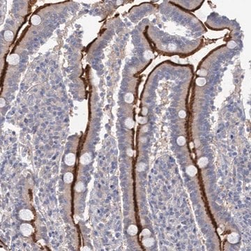 Anti-NEK10 antibody produced in rabbit Prestige Antibodies&#174; Powered by Atlas Antibodies, affinity isolated antibody, buffered aqueous glycerol solution