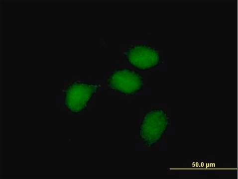 Anti-BCL3 antibody produced in mouse purified immunoglobulin, buffered aqueous solution