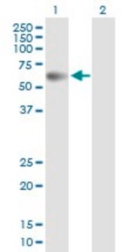 Anti-PPM1B antibody produced in mouse purified immunoglobulin, buffered aqueous solution