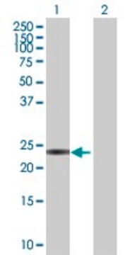 Anti-CIDEA antibody produced in rabbit purified immunoglobulin, buffered aqueous solution