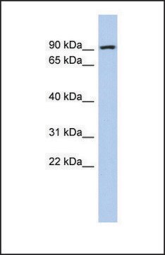 Anti-ALDH18A1, (N-terminal) antibody produced in rabbit affinity isolated antibody