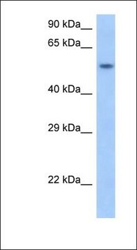 Anti-SNAPC1 antibody produced in rabbit affinity isolated antibody