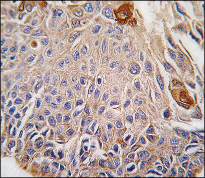 Anti-RMND5B (C-term) antibody produced in rabbit saturated ammonium sulfate (SAS) precipitated, buffered aqueous solution