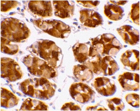 Anti-TRIM5-alpha-Antikörper from rabbit, purified by affinity chromatography