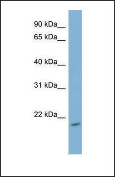 Anti-NME4 antibody produced in rabbit affinity isolated antibody