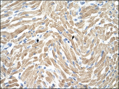 Anti-TPM1 IgG fraction of antiserum