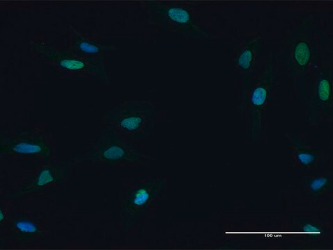 Anti-MCM5 antibody produced in mouse purified immunoglobulin, buffered aqueous solution