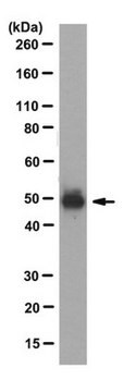 Anticuerpo anti-par-2, clon SAM11 clone SAM11, from mouse