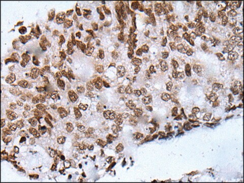 Anti-NHEJ1 affinity isolated antibody