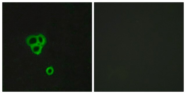 Anti-GPR119 antibody produced in rabbit affinity isolated antibody