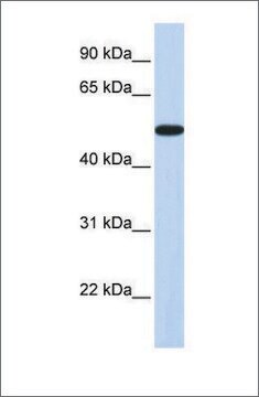 Anti-HOXA3 antibody produced in rabbit affinity isolated antibody