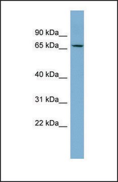 Anti-CACNB2 antibody produced in rabbit affinity isolated antibody