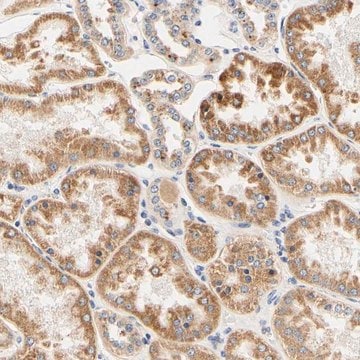 Anti-CAMK4 antibody produced in rabbit Prestige Antibodies&#174; Powered by Atlas Antibodies, affinity isolated antibody, buffered aqueous glycerol solution