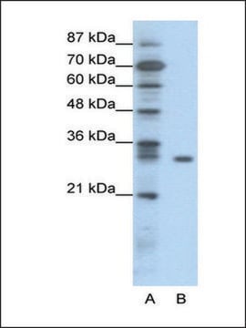 Anti-NFKBIB antibody produced in rabbit affinity isolated antibody