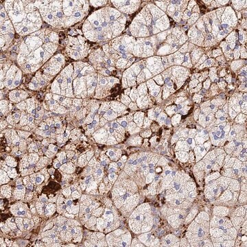 Anti-TLX2 antibody produced in rabbit Prestige Antibodies&#174; Powered by Atlas Antibodies, affinity isolated antibody, buffered aqueous glycerol solution