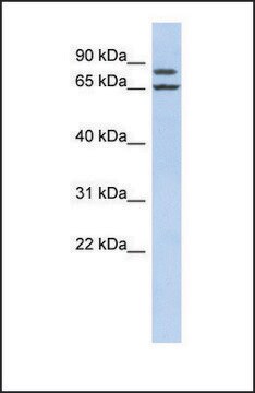 Anti-FSIP1 antibody produced in rabbit affinity isolated antibody