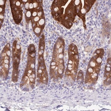 Anti-SULT1A2 antibody produced in rabbit Prestige Antibodies&#174; Powered by Atlas Antibodies, affinity isolated antibody, buffered aqueous glycerol solution