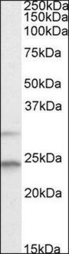 Anti-MAD2L1 (C-terminal) antibody produced in goat affinity isolated antibody, buffered aqueous solution